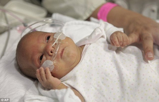 全球第三小婴儿奇迹存活出院回家 出生时体重比一罐可乐轻