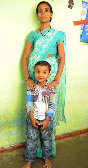 印度4岁男孩因病得福 长25根手指脚趾成小明星