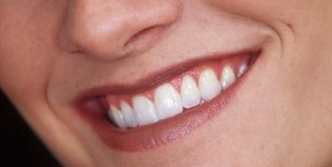 英科学家用牙龈细胞培育出新牙 摆脱假牙有希望