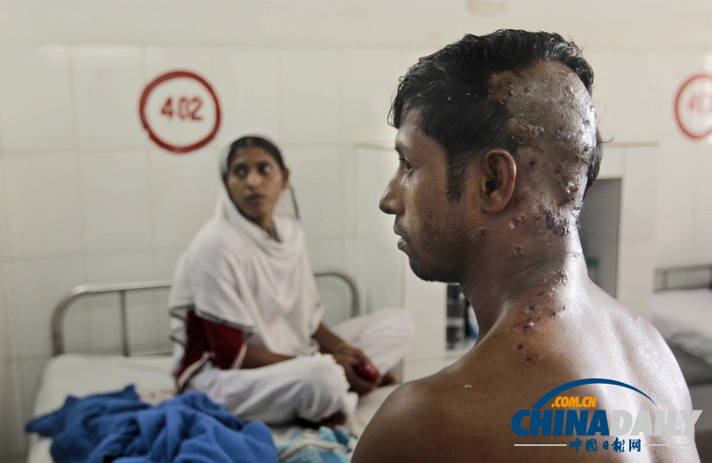 孟加拉国警方暴力驱散示威工人 多人被橡皮子弹打伤