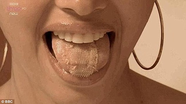 探访委内瑞拉世界小姐训练营：为减肥舌上缝塑料网（组图）