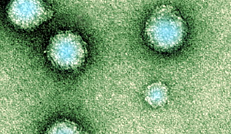 希腊暴发流感疫情 已导致40人死亡