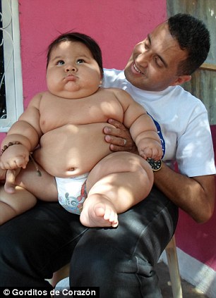 哥伦比亚8月大男婴体重近20公斤 赶上6岁儿童