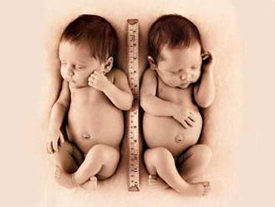 美罕见双胞胎牵手出生母亲曾被告知不孕