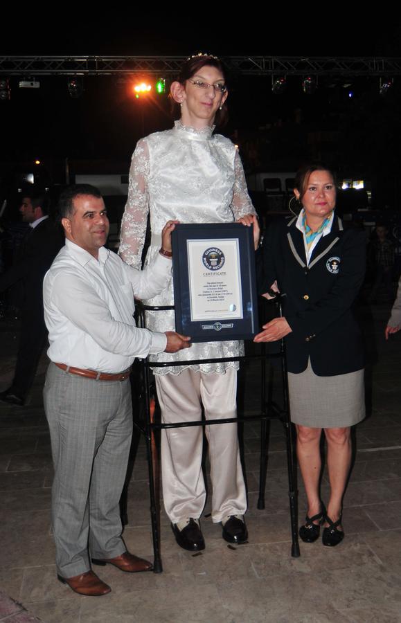 土耳其“巨人”少女获吉尼斯世界纪录