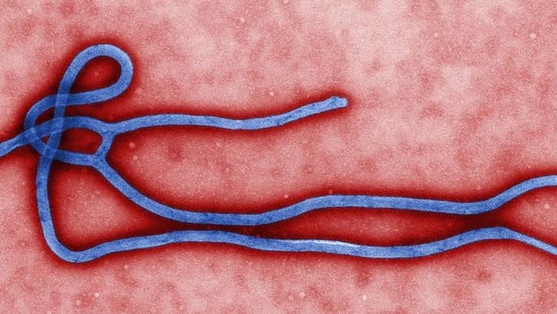 西非爆发史上最严重埃博拉疫情 美国发旅游警告