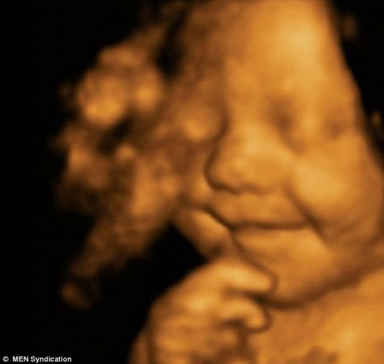 英国最幸福宝宝：从腹中胎儿到婴儿笑不停(图)