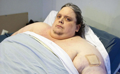 444公斤全球最胖男子因肺炎过世 抗争肥胖多年