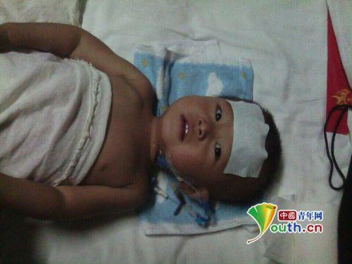 男婴患罕见肿瘤 父母为省钱一天只吃一个包子