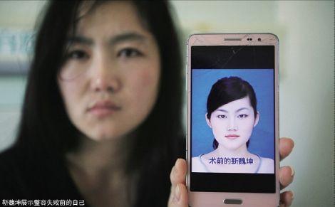 3名女子看节目后赴韩整容失败 示威维权被关警局