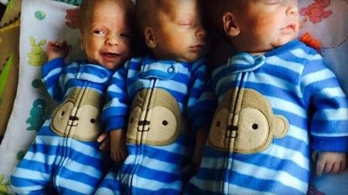 美国女子诞下同卵三胞胎 出现概率为百万分之一