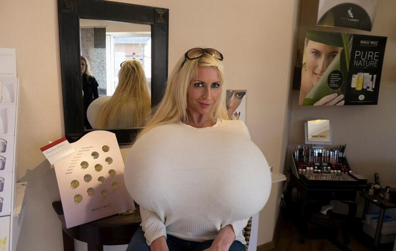 德国模特隆出世界最大胸部 植入18公斤盐水袋