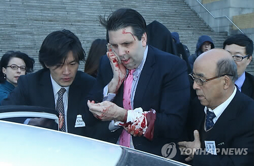 美驻韩大使李柏特遭袭击 脸部受重伤大出血