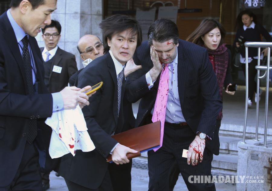 美国驻韩国大使遭袭击 脸部受伤大出血