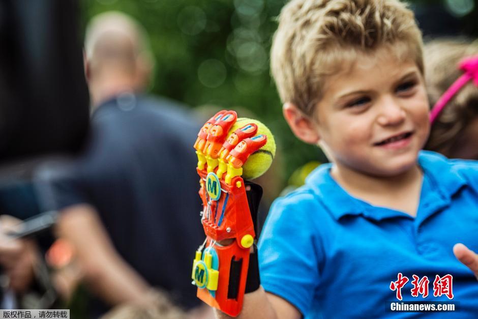 法国6岁男孩装3D打印假手