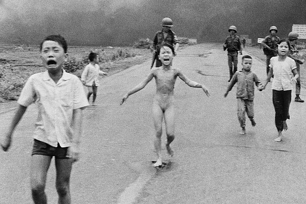越战裸奔女童43年后接受激光治疗求脱苦海