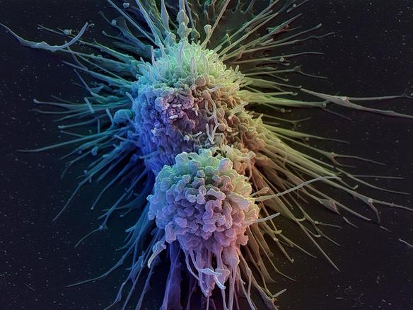 科学家：T淋巴细胞将提供持续有效的癌症疗法