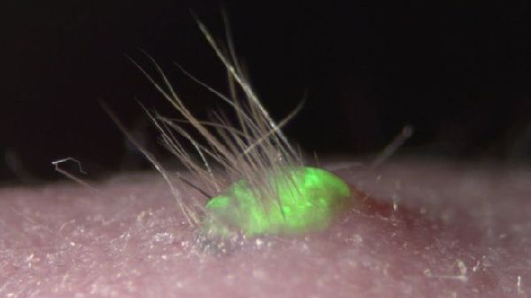 日本科学家用实验室培育皮肤细胞 移植后长出毛发
