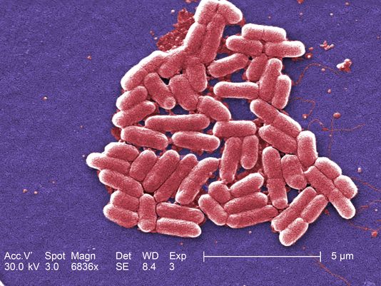 美国惊现“超级细菌” 最强抗生素也“束手无策”