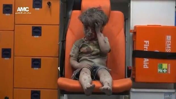 叙空袭中获救男童已和父母团聚 茫然眼神曾刺痛全世界