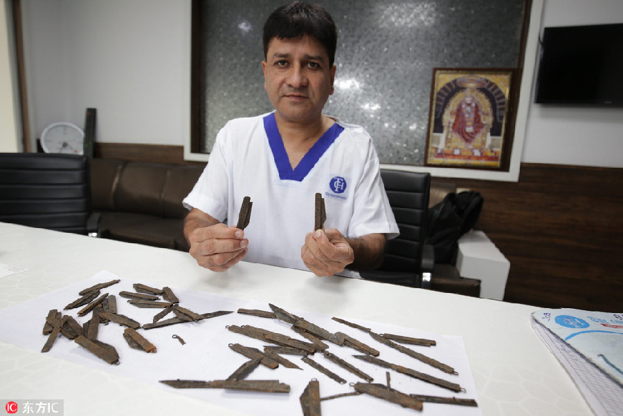 印度男子染上“吞刀”怪癖 胃里取出40把刀
