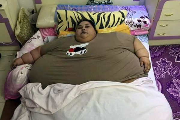 埃及“千斤”女子成全球最胖女性 25年未出家门