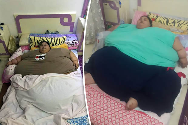 埃及“千斤”女子25年来将首出家门接受手术