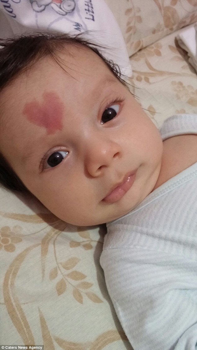 土耳其婴儿额头心形胎记 一出生就走红