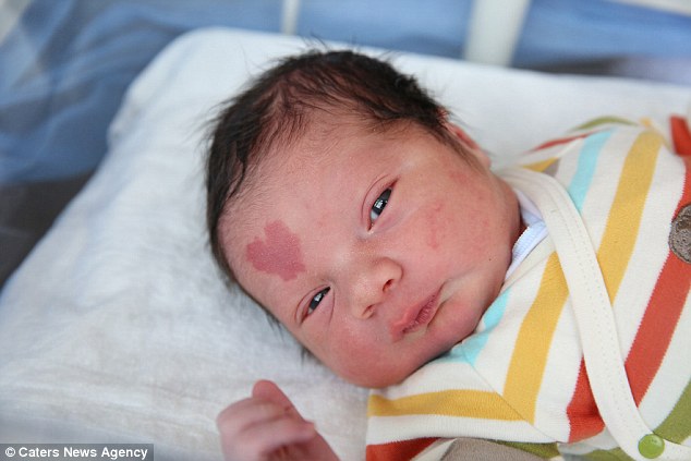 土耳其婴儿额头心形胎记 一出生就走红