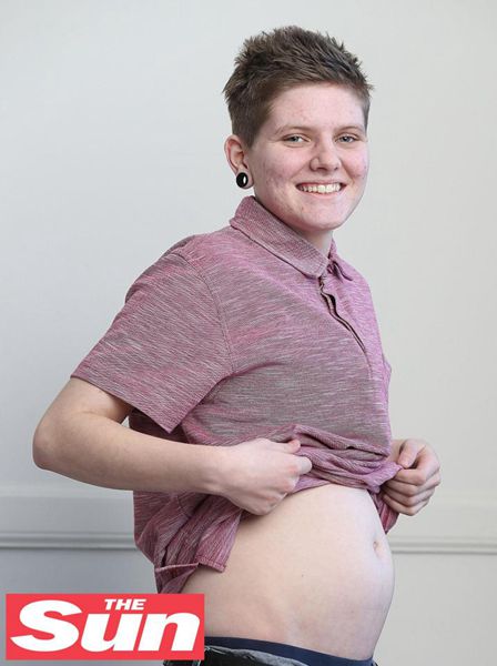 英国20岁变性男子宣布怀孕17周：我要当最棒的老爸