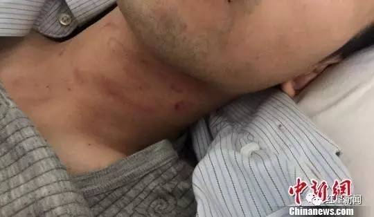 被打中国游客:宁可不去越南 也不在护照里夹钱