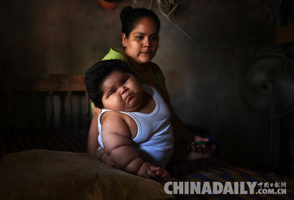 墨西哥10个月大婴儿重达56斤  该国肥胖儿童人数超500万