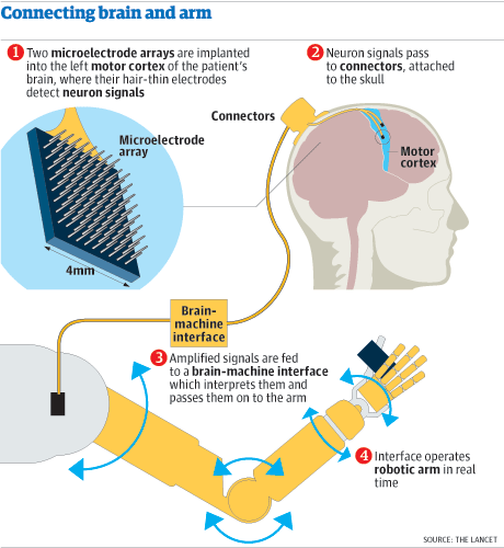美科学家发明新型脑控机械手臂 帮助残疾人用意念进食