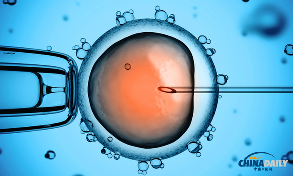 日本批准世界首例干细胞视网膜临床试验