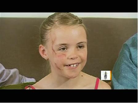 澳大利亚7岁女孩遭袋鼠袭击 浑身是伤仍立志当兽医