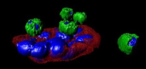 美科学家尝试为癌细胞染色 可迅速确定扩散方式和路径