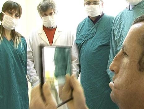 全球首例四肢移植手术完成 耗时20小时50名医生参与