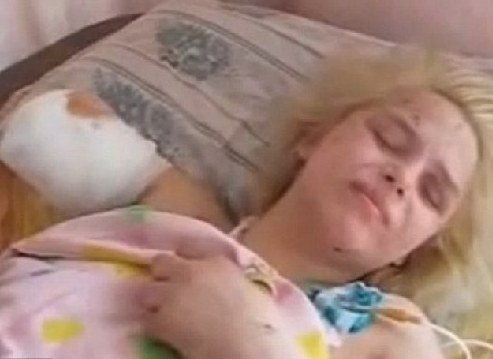 乌克兰惨遭轮奸焚烧18岁少女伤重不治不幸离世