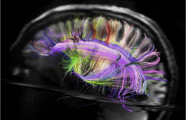 新型扫描仪揭示人脑神经纤维网格结构 有助于脑部疾病诊疗