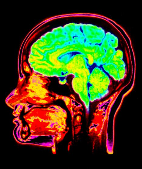 年龄无法作假 大脑核磁共振扫描可获知人类真实年龄