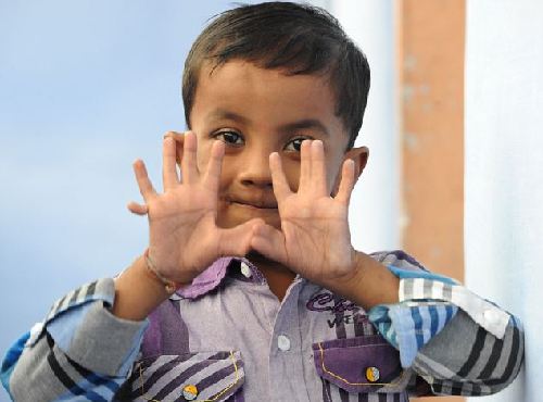 印度4岁男孩因病得福 长25根手指脚趾成小明星