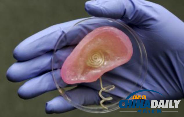 美科学家利用3D打印技术研制仿生耳 为病患造福