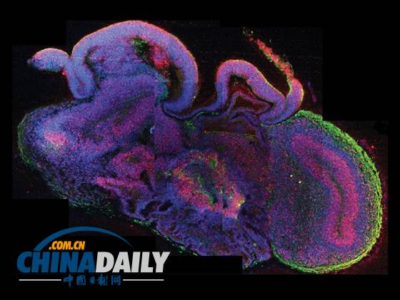 科学家利用干细胞培育人脑 达9周胎儿水平