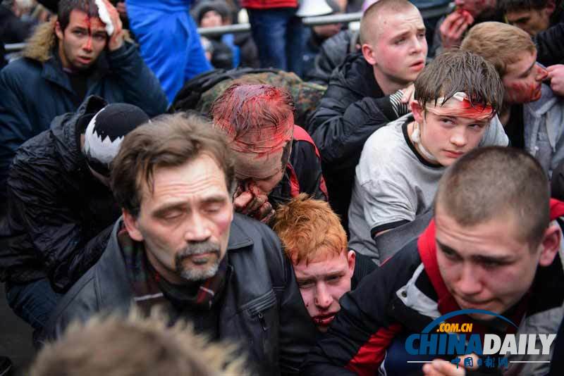 乌克兰受伤民众图片