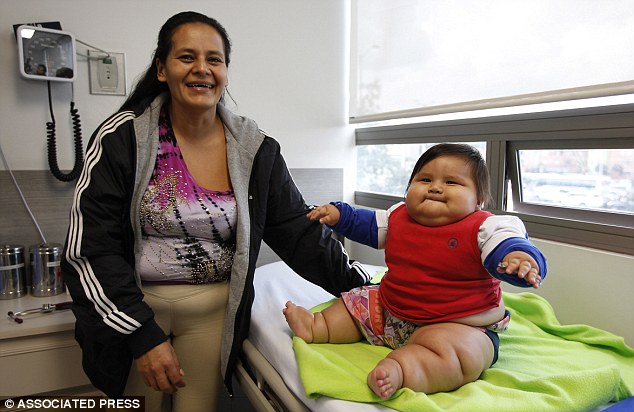 哥伦比亚8月大男婴体重近20公斤 赶上6岁儿童
