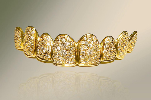 最“土豪”微笑：迪拜牙医制作镶钻金牙价值百万