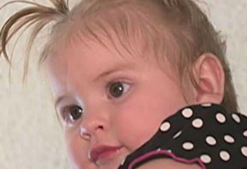 孕妇遭闪电击中 孩子出生1年后头发仍直立