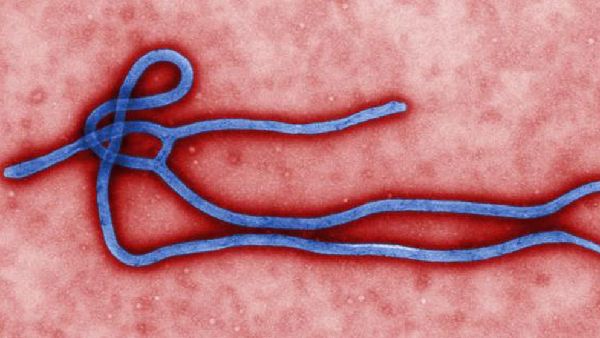 俄罗斯发现两例疑似埃博拉感染病例 但未得到证实