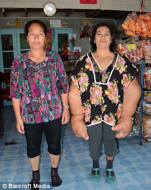 泰女子患罕见巨臂症 持近20公斤巨手痛苦59年