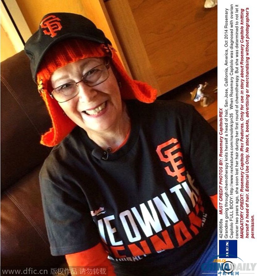 美71岁奶奶乐观抗癌 编出橙色“头发”超炫